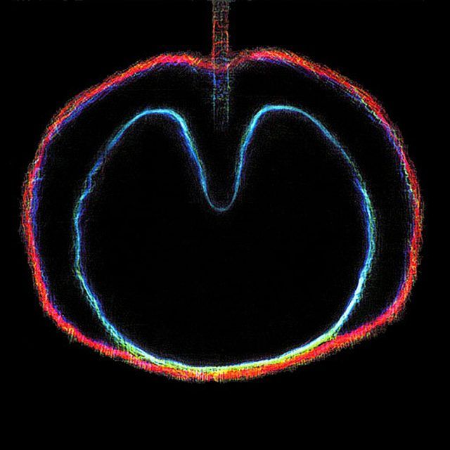 XTC apple-venus-volume-2-wasp-star XTC Wasp Star