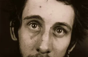 Shane MacGowan